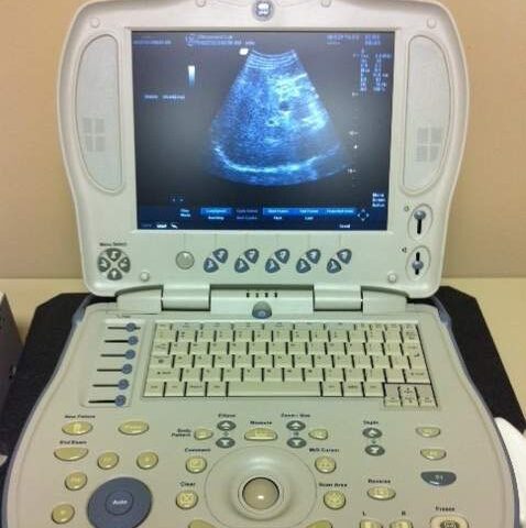 GE Logiq Book XP Ultrasound