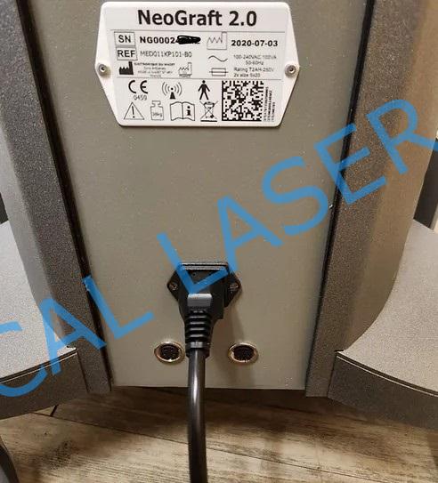 Neograft 2.0 Hair Restoration System