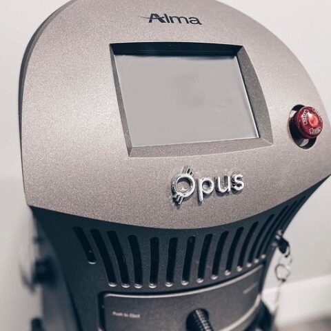 Alma Opus Plasma RF Fractional Skin Resurfacing