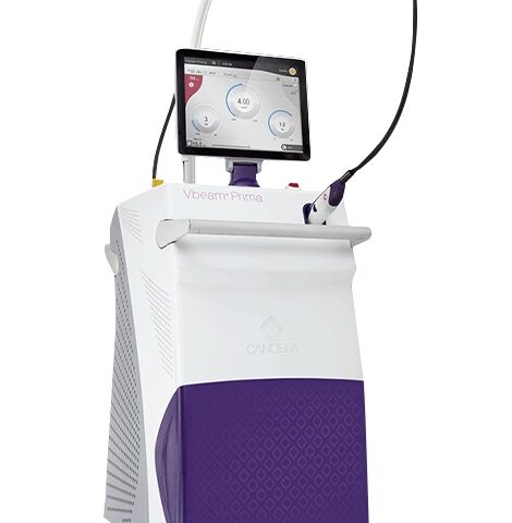 Candela VBeam Prima Laser Sale