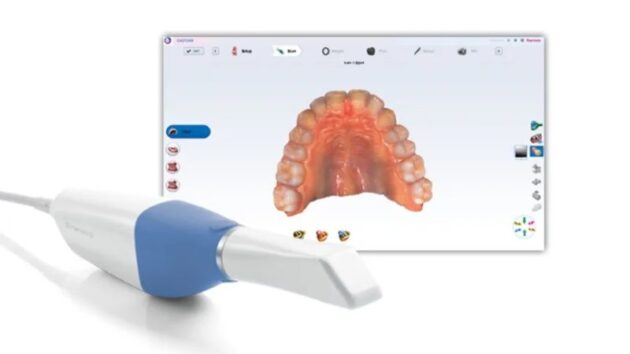 Planmeca Emerald S Digital Intraoral Scanner Sale