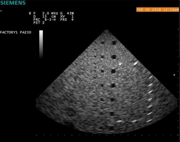 SIEMENS ACUSON P300 ULTRASOUND SYSTEM