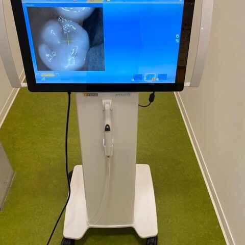 Sirona Apollo DI Intra Oral Scanner