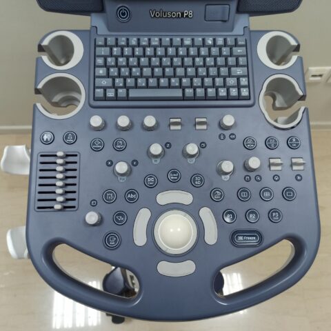 GE VOLUSON P8 ULTRASOUND