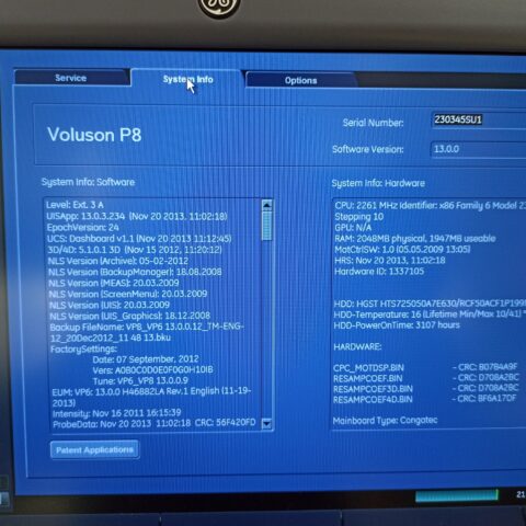 GE VOLUSON P8 ULTRASOUND