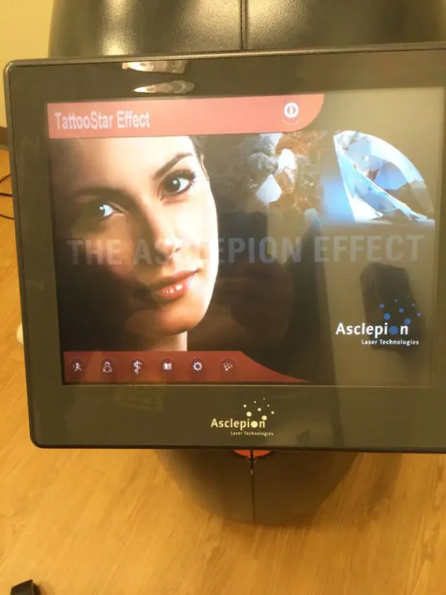 Asclepion TattooStar Effect Q-Switched Nd Yag Laser