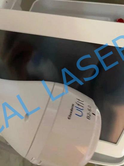 ulfit body contouring